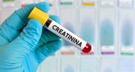 exame creatinina